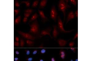 Immunofluorescence analysis of U2OS cells using PLCB1 Polyclonal Antibody (Phospholipase C beta 1 anticorps)