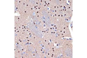 Immunohistochemistry of paraffin-embedded mouse brain using CTIP2/BCL11B Rabbit mAb (ABIN7265807) at dilution of 1:100 (40x lens). (BCL11B anticorps)