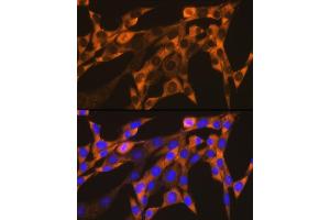 Immunofluorescence analysis of NIH-3T3 cells using YB-1/YBX1 Rabbit mAb (ABIN7271410) at dilution of 1:100 (40x lens).