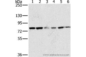 Western blot analysis of 293T and hela cell, human testis tissue, skov3, Raji and Jurkat cell, using NOX5 Polyclonal Antibody at dilution of 1:200 (NOX5 anticorps)