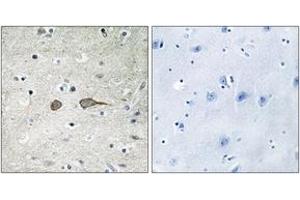 Immunohistochemistry analysis of paraffin-embedded human brain tissue, using MADD Antibody. (MADD anticorps  (AA 751-800))