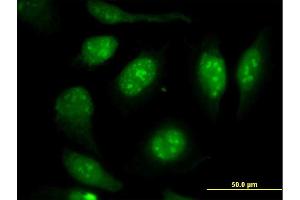 Immunofluorescence of monoclonal antibody to VIM on HeLa cell.
