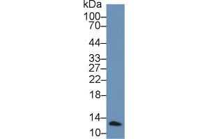 Rabbit Capture antibody from the kit in WB with Positive Control: Human leukocyte lysate. (beta-2 Microglobulin Kit CLIA)