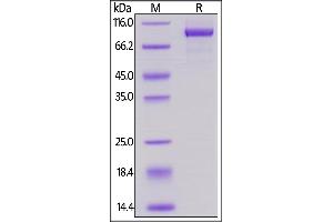 Biotinylated Human Her2, His,Avitag on  under reducing (R) condition.