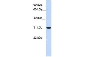 Carbonic Anhydrase VIII antibody used at 1 ug/ml to detect target protein.