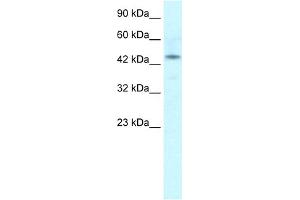 WB Suggested Anti-IRX2 Antibody Titration:  1. (IRX2 anticorps  (Middle Region))