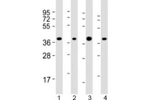Western blot testing of human 1) HepG2, 2) Jurkat, 3) Li-7 and 4) RPMI-8226 cell lysate with ARHGEF39 antibody at 1:2000.