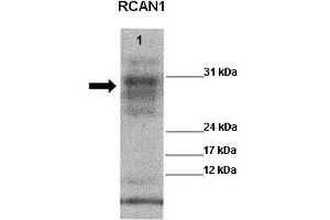 WB Suggested Anti-RCAN1 Antibody    Positive Control:  Lane 1: 20ug Wild type mouse, left ventricle   Primary Antibody Dilution :   1:1000  Secondary Antibody :  Goat anti rabbit-HRP   Secondry Antibody Dilution :   1:5,000  Submitted by:  Kathleen Gabrielson (RCAN1 anticorps  (Middle Region))