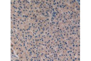 Used in DAB staining on fromalin fixed paraffin- embedded liver cancer tissue