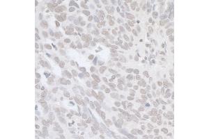 Immunohistochemistry (IHC) image for anti-Breast Cancer 1 (BRCA1) (AA 700-750) antibody (ABIN7449153)