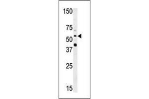 Western blot analysis of anti-NMT2 Pab (ABIN389095 and ABIN2839287) in HepG2 cell line lysate (35 μg/lane).