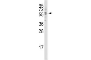 Western blot analysis of Tip60 antibody in Jurkat lysate (KAT5 anticorps  (AA 33-64))