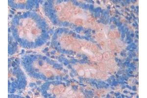 Detection of JAK2 in Rat Small intestine Tissue using Polyclonal Antibody to Janus Kinase 2 (JAK2)