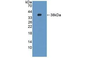 Detection of Recombinant DEFb2, Mouse using Polyclonal Antibody to Defensin Beta 2 (DEFb2) (beta 2 Defensin anticorps  (AA 21-71))