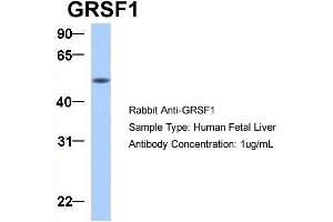 Host:  Rabbit  Target Name:  GRSF1  Sample Type:  Human Fetal Liver  Antibody Dilution:  1. (GRSF1 anticorps  (Middle Region))