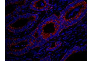 Immunofluorescence (IF) image for anti-MAP-Kinase Activating Death Domain (MADD) (AA 1597-1647) antibody (ABIN7448984) (MADD anticorps  (AA 1597-1647))