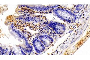 Detection of IBA1 in Rat Colon Tissue using Polyclonal Antibody to Ionized Calcium-binding Adapter Molecule 1 (IBA1)