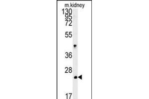 LHPL3 Antibody (C-term) (ABIN651908 and ABIN2840448) western blot analysis in mouse kidney tissue lysates (15 μg/lane). (LHFPL3 anticorps  (C-Term))
