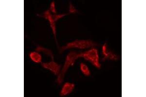 ABIN6278321 staining  COLO205 cells by IF/ICC. (SPTBN1 anticorps  (N-Term))
