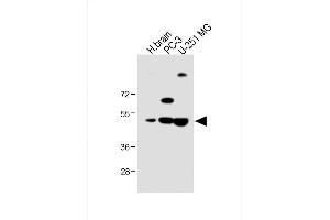 All lanes : Anti-M1 Antibody (Center) at 1:1000 dilution Lane 1: Human brain lysate Lane 2: PC-3 whole cell lysate Lane 3: U-251 MG whole cell lysate Lysates/proteins at 20 μg per lane.