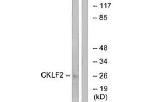 Western Blotting (WB) image for anti-CKLF-Like MARVEL Transmembrane Domain Containing 2 (CMTM2) (AA 171-220) antibody (ABIN2890220) (CMTM2 anticorps  (AA 171-220))