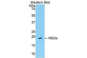 Western Blotting (WB) image for anti-Angiopoietin 1 (ANGPT1) (AA 304-450) antibody (ABIN3209767) (Angiopoietin 1 anticorps  (AA 304-450))