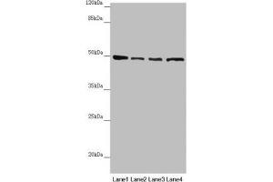 Western blot All lanes: AP1M1 antibody at 1.