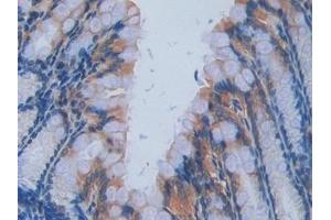 anti-Interleukin 17 Receptor A (IL17RA) (AA 590-848) antibody