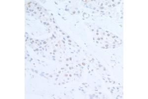 anti-Ubiquitin Protein Ligase E3 Component N-Recognin 5 (UBR5) (AA 600-650) antibody