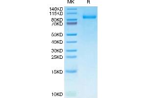 Human G-CSF R on Tris-Bis PAGE under reduced condition. (CSF3R Protein (AA 25-627) (His tag))