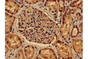 Immunohistochemistry of paraffin-embedded human kidney tissue using ABIN7162722 at dilution of 1:100 (PDLIM2 anticorps  (AA 161-284))