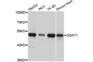 Western blot analysis of extracts of various cell lines, using DGAT1 antibody. (DGAT1 anticorps  (AA 200-300))