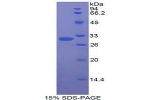SDS-PAGE analysis of Human Karyopherin alpha 2 Protein. (KPNA2 Protéine)