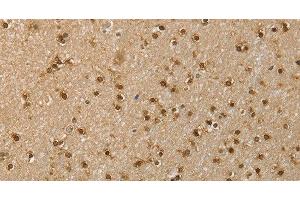 Immunohistochemistry of paraffin-embedded Human brain using RNH1 Polyclonal Antibody at dilution of 1:40 (RNH1 anticorps)