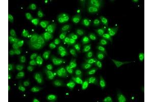 Immunofluorescence analysis of A-549 cells using SMYD3 antibody (ABIN6128709, ABIN6148169, ABIN6148170 and ABIN6223146). (SMYD3 anticorps  (AA 140-369))