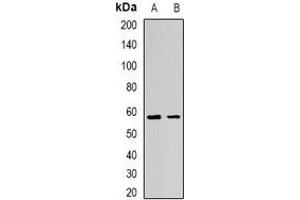 Western blot analysis of AdipoR1 expression in BT474 (A), mouse skeletal muscle (B) whole cell lysates.