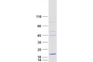 Validation with Western Blot