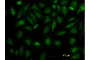 Immunofluorescence of monoclonal antibody to FH on HeLa cell.
