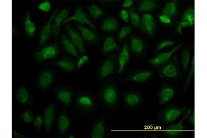 Immunofluorescence of monoclonal antibody to FH on HeLa cell. (FH anticorps  (AA 33-510))