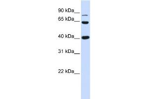 WB Suggested Anti-CTNNB1 Antibody Titration: 0.