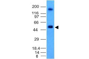 Image no. 2 for anti-Carbonic Anhydrase IX (CA9) antibody (ABIN6182201)