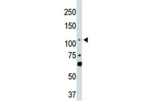 LATS2 antibody used in western blot to detect LATS2 in NIH3T3 cell lysate