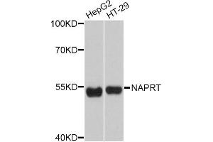 Western blot analysis of extracts of various cell lines, using NAPRT Antibody (ABIN4904492) at 1:3000 dilution. (NAPRT1 anticorps)