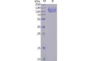 Human CD155 Protein, hFc Tag on SDS-PAGE under reducing condition.