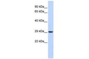 Image no. 1 for anti-Proteasome Subunit Alpha Type 3 (PSMA3) (C-Term) antibody (ABIN6744210)