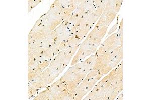Immunohistochemistry of paraffin embedded mouse heart using SMNDC1 (ABIN7075773) at dilution of 1:1000 (400x lens)