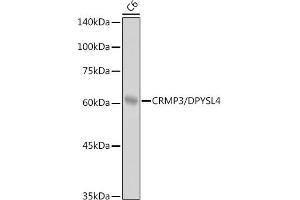 Western blot analysis of extracts of C6 cells, using CRMP3/DPYSL4 antibody (ABIN7266772) at 1:1000 dilution. (DPYSL4 anticorps)