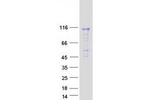 Validation with Western Blot (DENND1C Protein (Myc-DYKDDDDK Tag))