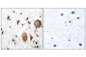 Immunohistochemistry (IHC) image for anti-Glutamate Receptor, Metabotropic 8 (GRM8) (C-Term) antibody (ABIN1848581) (GRM8 anticorps  (C-Term))