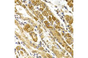 Immunohistochemistry of paraffin-embedded human stomach using BMP15 antibody at dilution of 1:100 (x40 lens). (BMP15 anticorps)